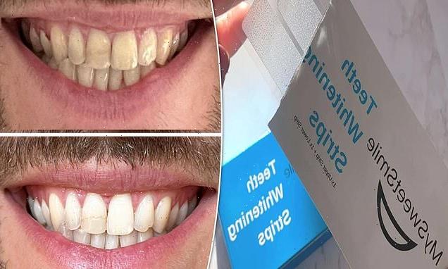 These £30 teeth whitening strips make their smile 'sparkle again'