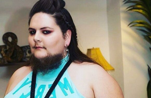 Woman who shaved twice a day after growing beard at 13 now embracing facial hair