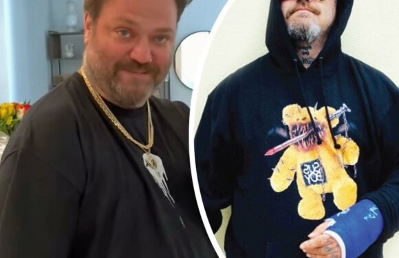 Bam Margera Hospitalized With Serious Pneumonia & COVID-19 – And Put On A Ventilator!