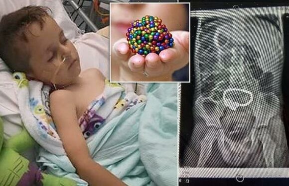 Boy, five, has emergency surgery after swallowing 52 magnetic beads