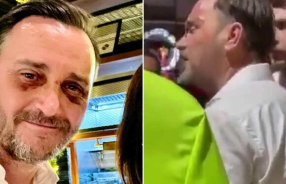 Celebrity chef Jason Atherton left with two black eyes after taking on thugs 'harassing his daughter, 17’ in bar | The Sun