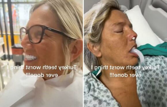 I got Turkey Teeth – it was the worst mistake of my life, I have never been in so much pain and they look ridiculous | The Sun