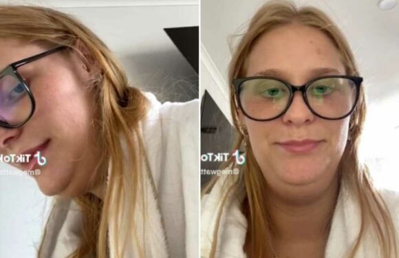 I had the fat in my double chin dissolved but wasn't prepared for just how swollen I'd be – I looked like Peter Griffin | The Sun