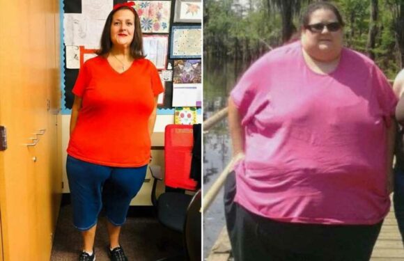 I weighed 42st but shed HALF my bodyweight to save my life – here's what my ‘hanging apron’ of loose skin looks like | The Sun