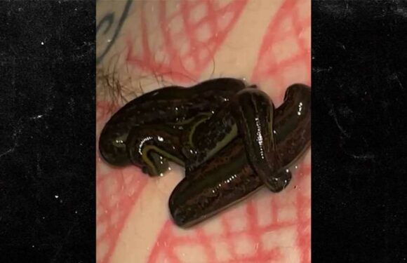 Machine Gun Kelly Puts Leeches on Stomach in Nasty Video