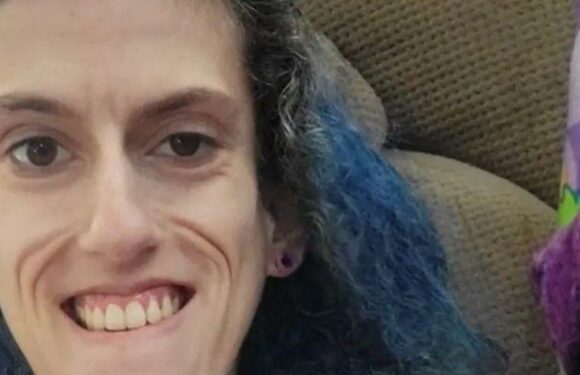 Mum defies trolls as extremely rare condition leaves her looking like rag doll