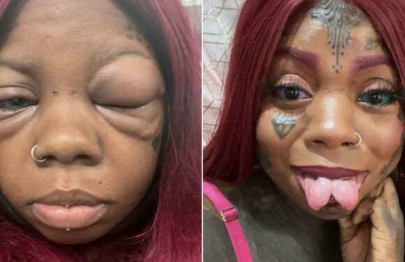 Mum ‘going blind’ after tattooing eyeballs ‘looks like she had fight with Tyson’