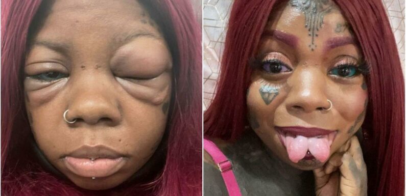 Mum ‘going blind’ after tattooing eyeballs ‘looks like she had fight with Tyson’