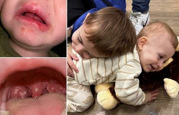 Parents of children who have fought Strep A warn people of THESE signs