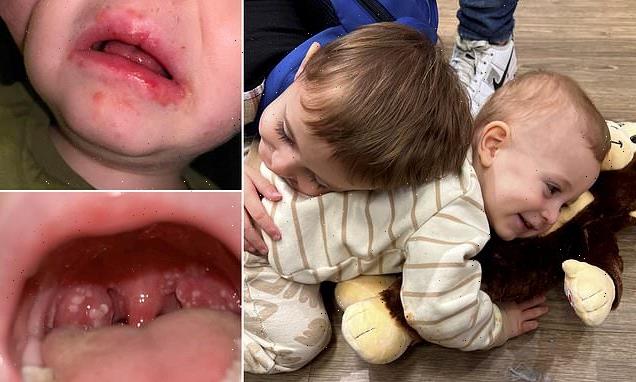 Parents of children who have fought Strep A warn people of THESE signs