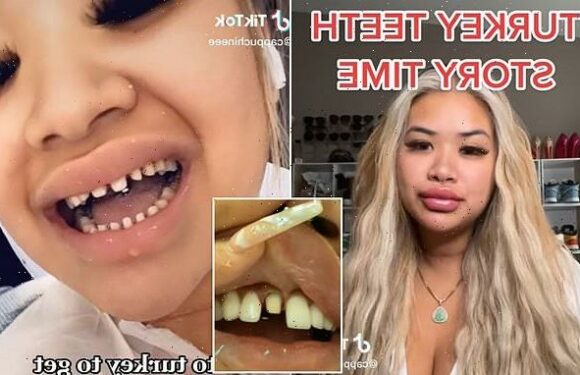 Woman reveals her nightmare $26k 'Turkey teeth' makeover
