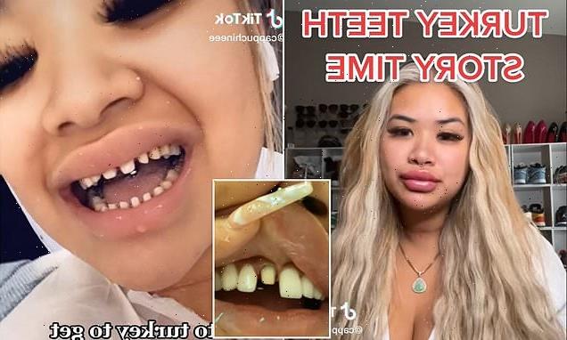 Woman reveals her nightmare $26k 'Turkey teeth' makeover