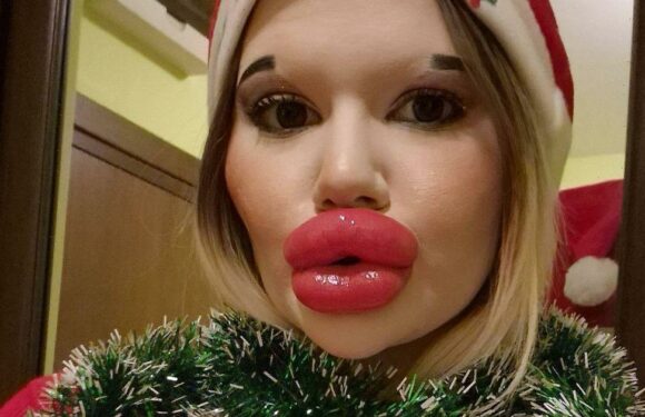 Woman with worlds biggest lips offers mistletoe kiss this Xmas – to highest bid