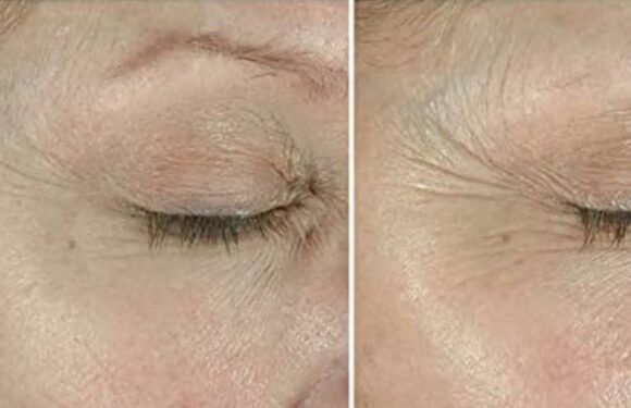 97% of Users Say This Cream Helped Their Eye Area Look Tighter and Firmer