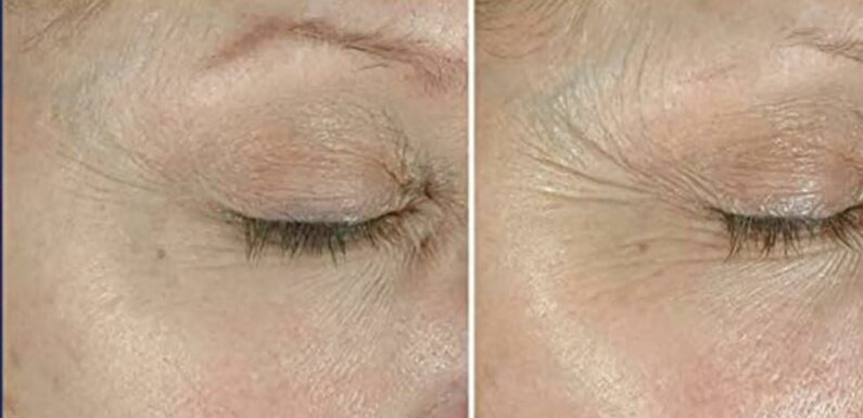 97% of Users Say This Cream Helped Their Eye Area Look Tighter and Firmer