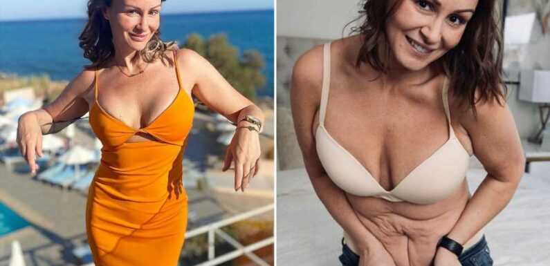 Chanelle Hayes is going under the knife again for tummy tuck and new boobs after 10st weight loss | The Sun