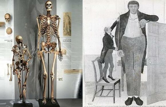 Charles Byrne's skeleton on show for two centuries against his wishes