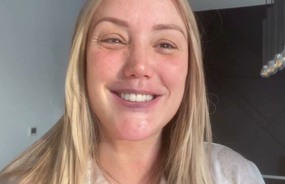 Charlotte Crosby says lips were ridiculous as she reveals reason for dissolving filler