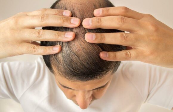 Drinking energy drinks accelerates hair loss for men, study finds