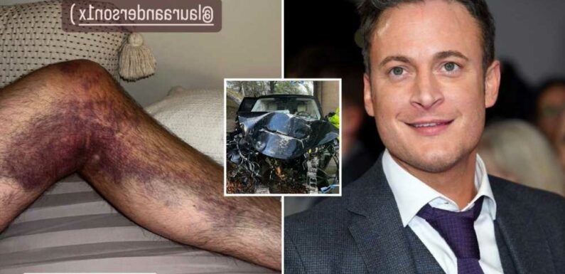 Gary Lucy shocks fans with gruesome pic of his knee injury after horror car crash | The Sun