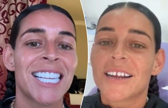 I flew to Turkey for a new set of teeth – trolls say they're too bright and think I'll regret it but I love them | The Sun