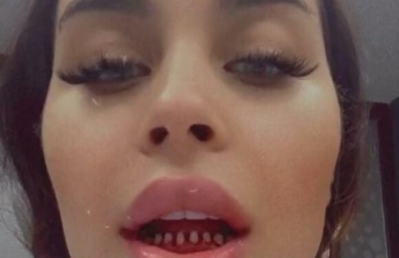 I flew to Turkey for new teeth – I looked like a piranha during the process and people say my teeth were better before | The Sun