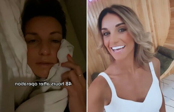 I flew to Turkey to get my teeth done, I spent £6k and was in the dentist for 15 hours and was bed-bound for four days | The Sun