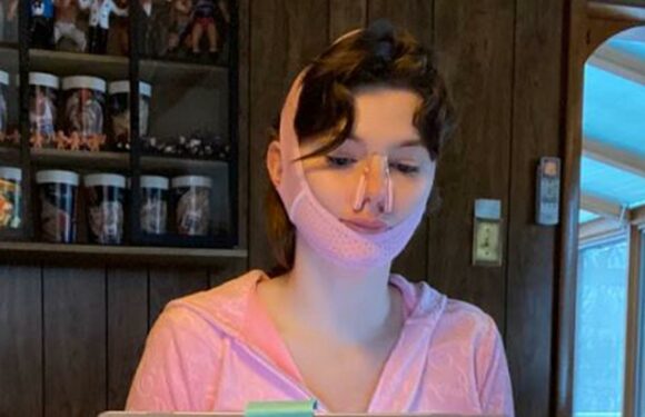 I spent $38 on Amazon products to shape my jaw, lips, and nose – two are must-buys if you're considering plastic surgery | The Sun