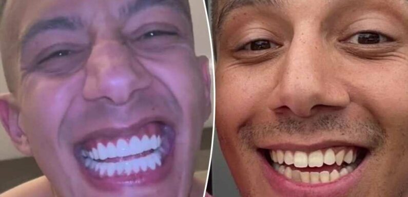 I splashed £3.7k on bright white Turkey teeth – trolls say I'll regret it but I don't care, I'm buzzing with my smile | The Sun