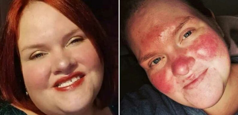 I was branded a tomato by cruel bully at work while strangers told me I was ugly – but now I've found a cure | The Sun