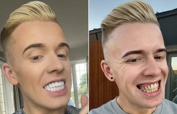 Influencer says people call him a 'piano'