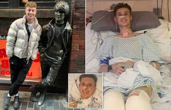 Man, 21, has legs amputated days before birthday after catching flu
