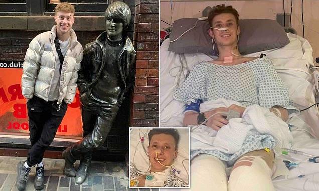 Man, 21, has legs amputated days before birthday after catching flu