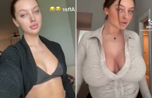 My boobs have TOTALLY disappeared after I lost weight… people think I’ve had them removed, I don't know what happened | The Sun