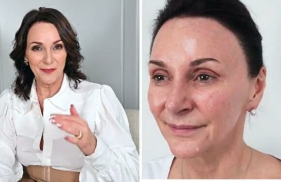 Shirley Ballas looks ageless after ‘alternative’ face-lift