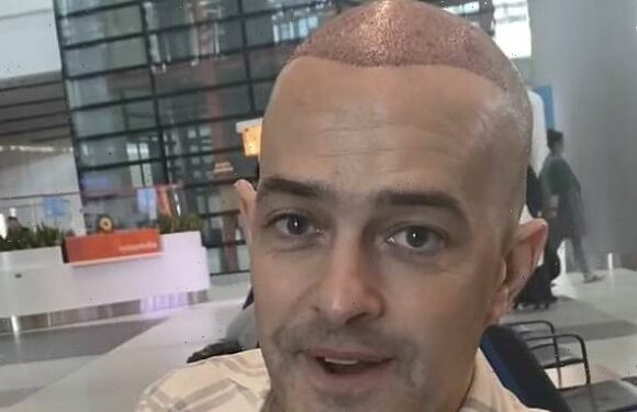 Soapstar looks unrecognisable as he shaves off his famous curls