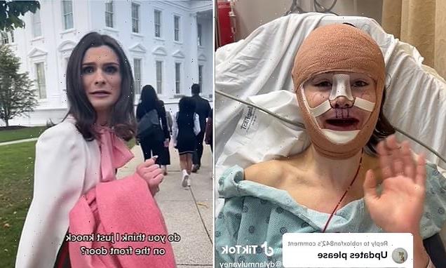 Transgender influencer shows off scarred face after undergoing surgery