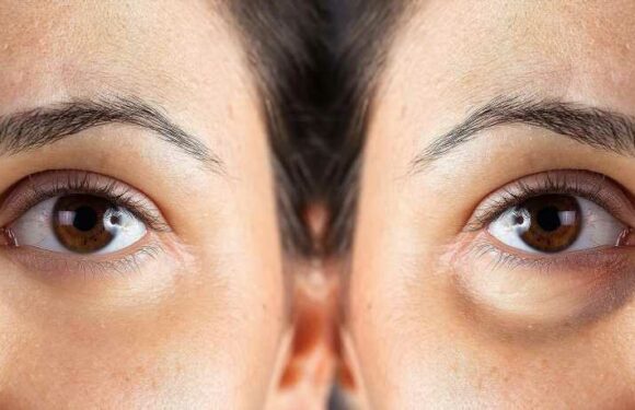 You Could See a Noticeable Difference After Just 3 Days With This Eye Cream