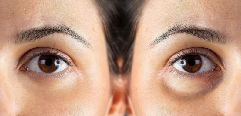You Could See a Noticeable Difference After Just 3 Days With This Eye Cream