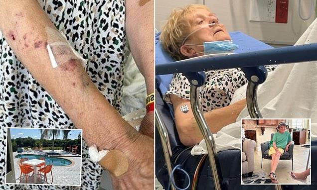 British woman 'lucky to be alive' after catching disease from hot-tub