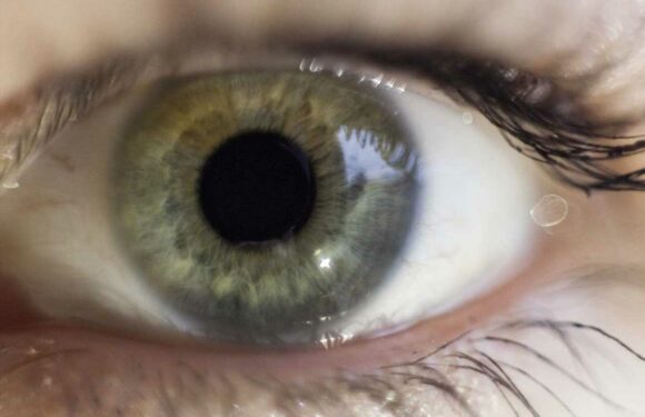 How a twitching eye could be a sign of something serious – and when to see your GP | The Sun
