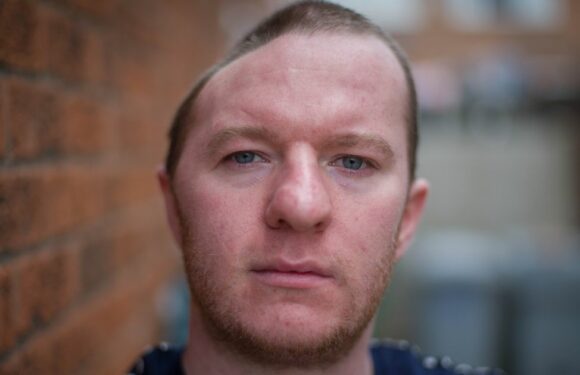 ‘I lost half my skull after brutal punch – now I have to wear a helmet outside’