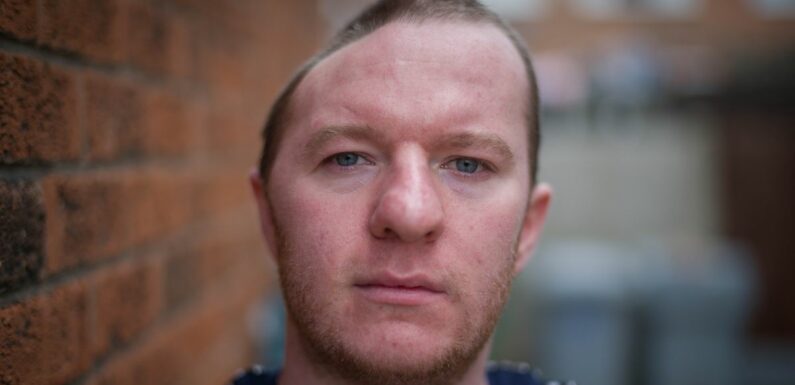 ‘I lost half my skull after brutal punch – now I have to wear a helmet outside’