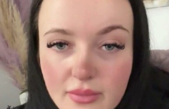 I splashed £3.1k on a gastric sleeve in Turkey but there's been loads of surprises since – I lost 70% of my hair for one | The Sun