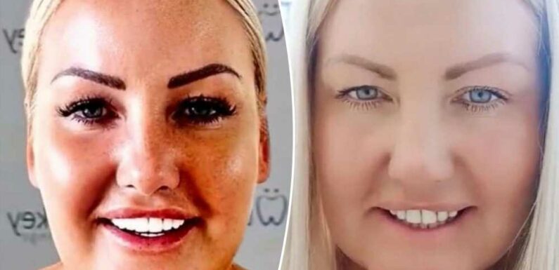 I splashed £4k on Turkey teeth because I wanted a white smile – trolls say I may as well have thrown my money in the bin | The Sun
