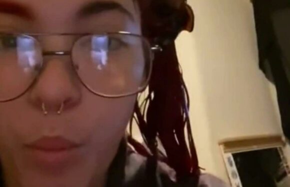 I was keen to try the half-and-half hair dye trend but it was a total fail – my face was such a state I ended up in A&E | The Sun