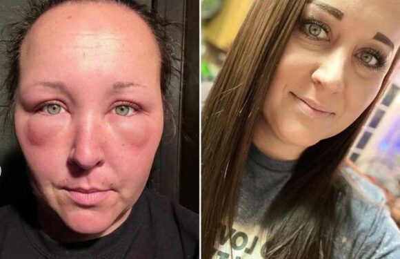 I was left looking like a Space Raider after my DIY hair dye job went horribly wrong | The Sun