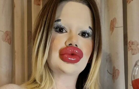 I’m a plastic surgery fanatic with ‘world’s biggest lips’ – but now I’m going to set NEW world record | The Sun