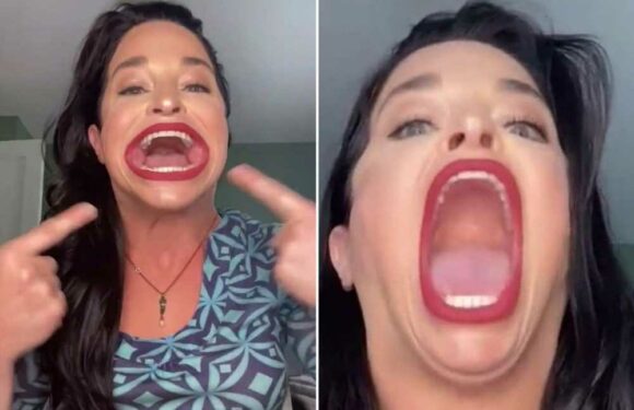 I’ve got the largest mouth in the world – I was bullied for it but now I’ve embraced my uniqueness & love showing it off | The Sun