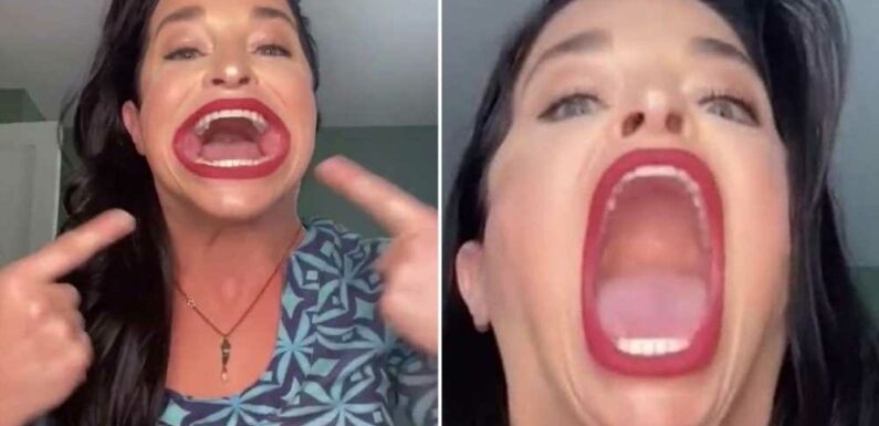 I’ve got the largest mouth in the world – I was bullied for it but now I’ve embraced my uniqueness & love showing it off | The Sun